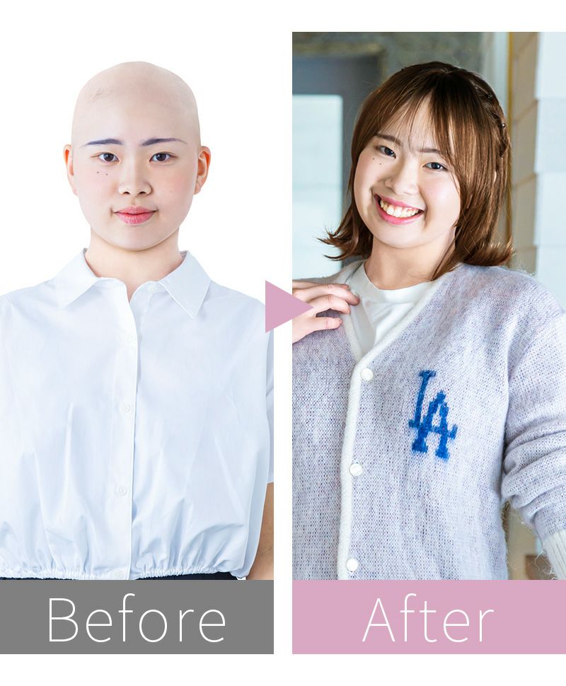 帽子ウィッグ（フィット）【外ハネボブ】 品番BO-13耐熱 カラーGTDM 耐熱グラデデイリーマロン ビフォーアフター 2