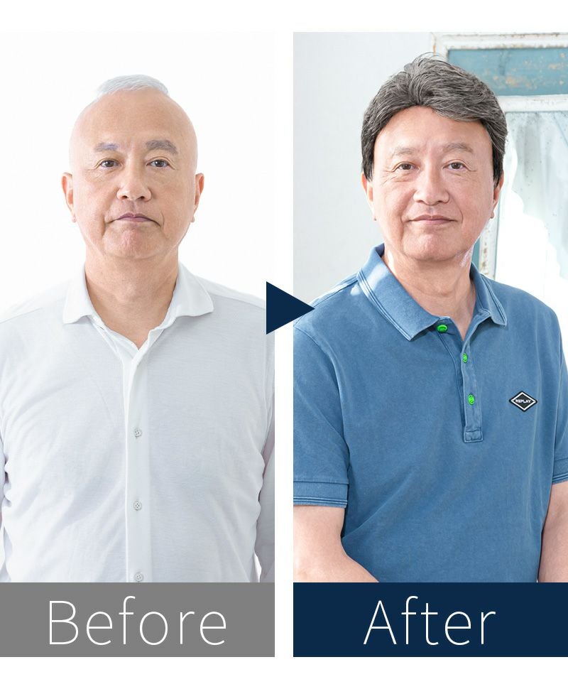  メンズ帽子ウィッグ【リッチショート】BO-100 BEFOREAFTER