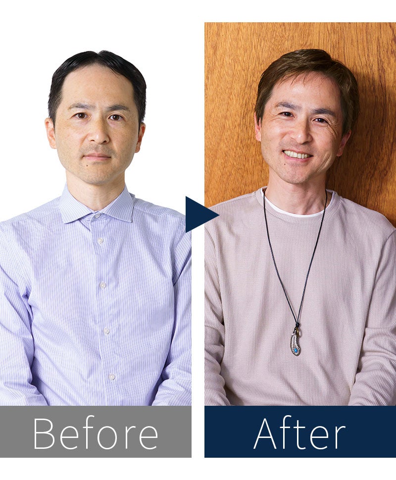 プリシラマン(人毛ミックス)【スタンダードショート】MA-002　モデル着用　BEFOREAFTER