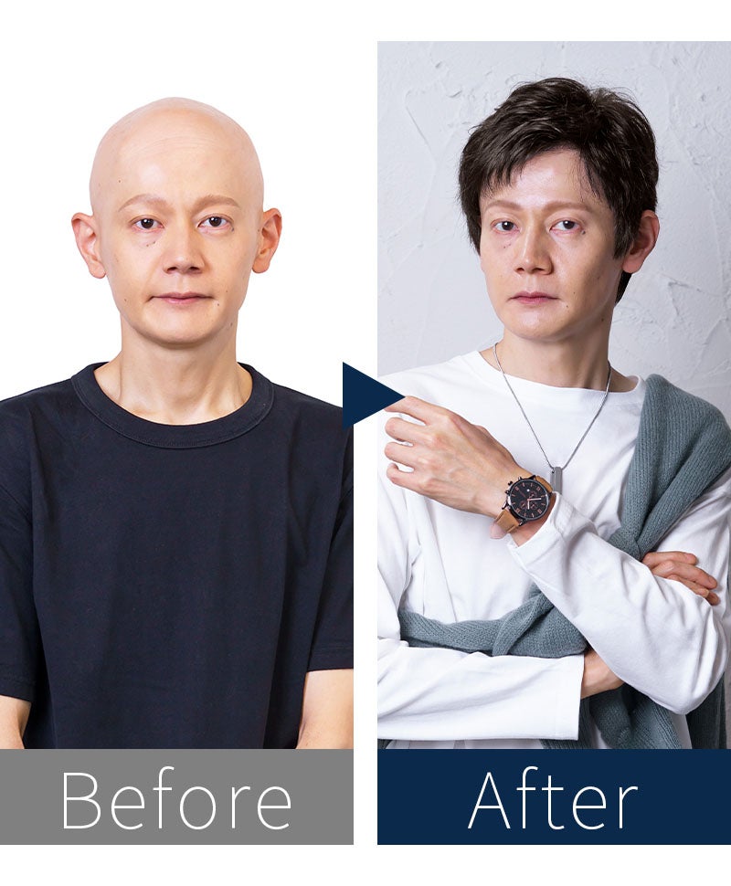 プリシラマン(人毛ミックス)【スタンダードショート】MA-002　モデル着用　BEFOREAFTER