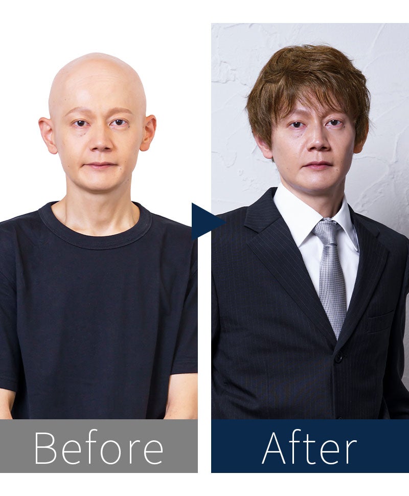 プリシラマン(人毛ミックス)【ニュアンスカールショート】MA-003　モデル着用　BEFOREAFTER