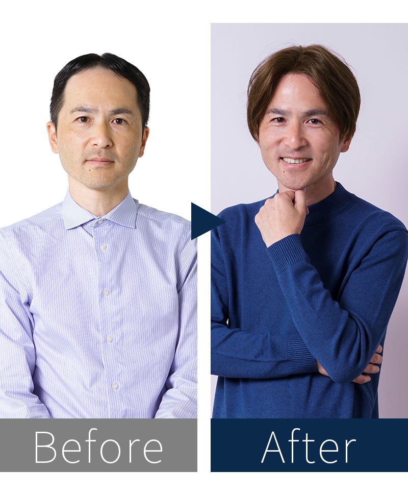 プリシラマン(人毛ミックス)【ナチュラルセンターショート】MA-004　モデル着用　BEFOREAFTER