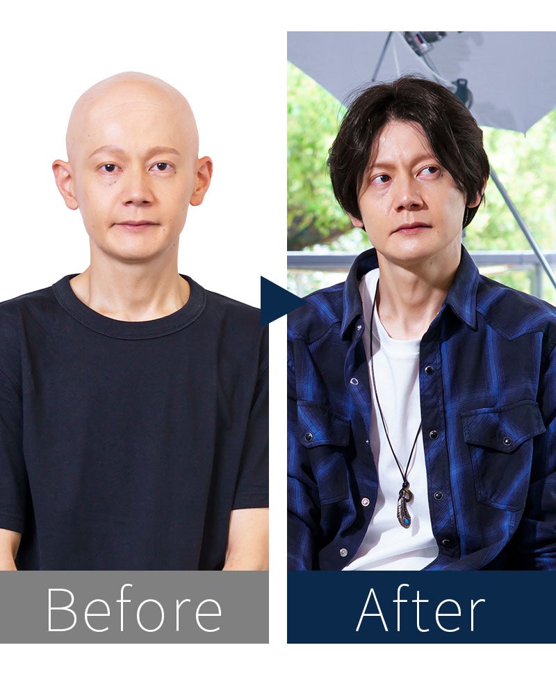 プリシラマン(人毛ミックス)【ナチュラルセンターショート】MA-004　モデル着用　BEFOREAFTER