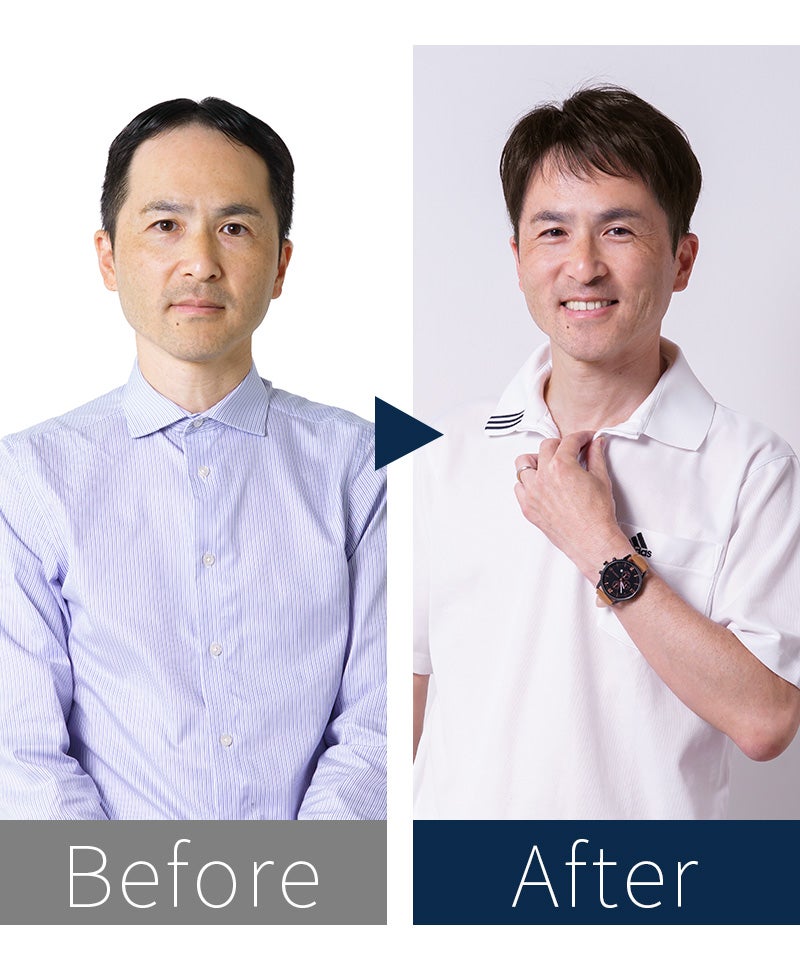 人毛ミックス男性用五分ウィッグ【リッチショート】GB-100 モデル着用　before after