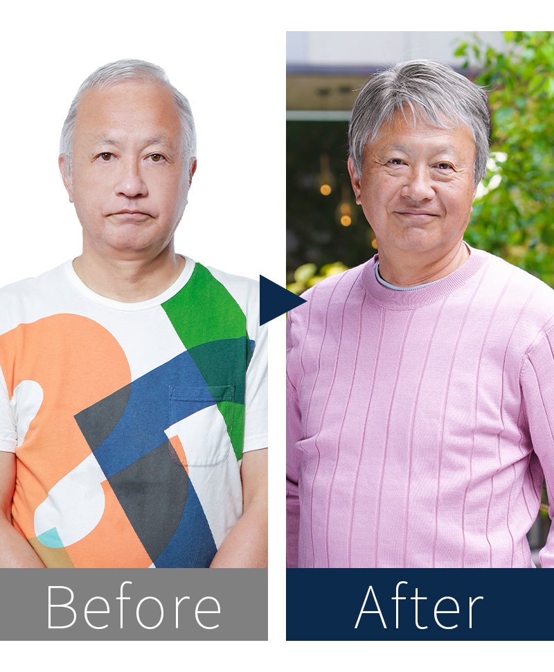 人毛ミックス男性用五分ウィッグ【リッチショート】GB-100 シニアモデル着用　before after
